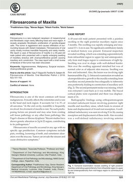 Fibrosarcoma of Maxilla CASE REPORT