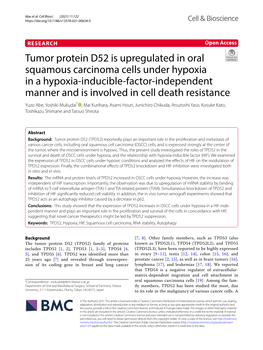 Tumor Protein D52 Is Upregulated in Oral Squamous Carcinoma Cells