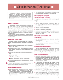 Skin Infection (Cellulitis) N