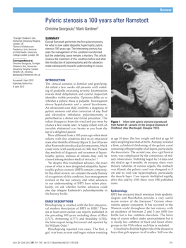 Pyloric Stenosis a 100 Years After Ramstedt Christina Georgoula,1 Mark Gardiner2