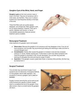 Ganglion Cyst of the Wrist, Hand, and Finger Nonsurgical Treatment Surgical Treatment