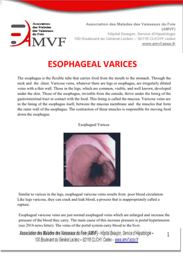 Esophageal Varices