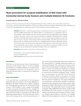 Nuss Procedure for Surgical Stabilization of Flail Chest with Horizontal Sternal Body Fracture and Multiple Bilateral Rib Fractures