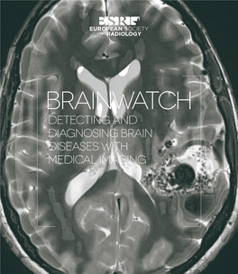 Detecting and Diagnosing Brain Diseases with Medical Imaging Table of Contents 3 Brainwatch Table of Contents
