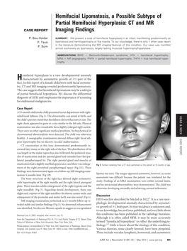 Hemifacial Lipomatosis, a Possible Subtype of Partial Hemifacial Hyperplasia: CT and MR Imaging Findings