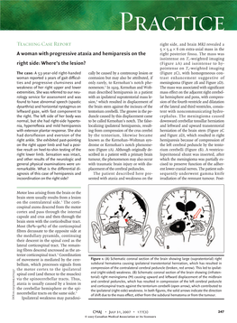 A Woman with Progressive Ataxia and Hemiparesis on the Right Side