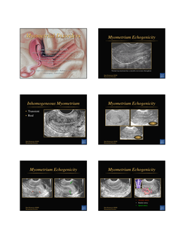 Myometrial Disorders Myometrium Echogenicity