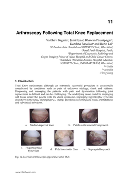 Arthroscopy Following Total Knee Replacement