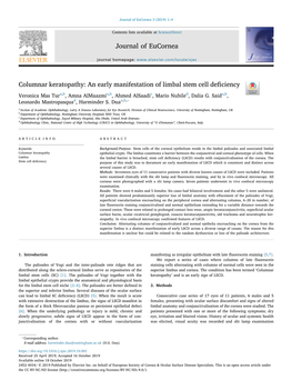 Columnar Keratopathy an Early Manifestation of Limbal Stem Cell