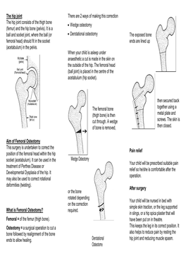 The Hip Joint Aim of Femoral Osteotomy What Is Femoral