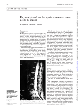 Polymyalgia and Low Back Pain: a Common Cause Not to Be Missed