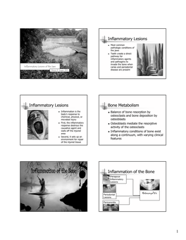 Inflammation of the Bone Inflammation of the Bone Periapical Inflammatory Lesions