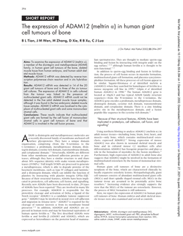 The Expression of ADAM12 (Meltrin Α) in Human Giant Cell Tumours of Bone B L Tian, J M Wen, M Zhang, D Xie,Rbxu,Cjluo