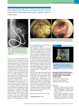 Electrohydraulic Lithotripsy of Large Bile Duct Stones Under Direct Cholangioscopy with a Double-Balloon Endoscope