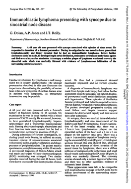 Immunoblastic Lymphoma Presenting with Syncope Due to Sinoatrial Node Disease