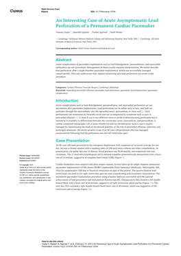 An Interesting Case of Acute Asymptomatic Lead Perforation of a Permanent Cardiac Pacemaker