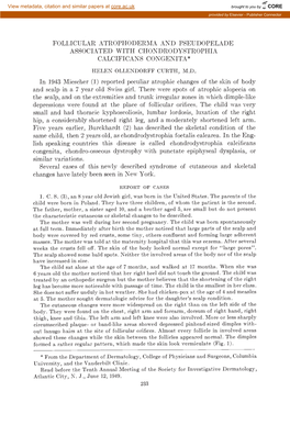 Follicular Atrophoderma and Pseudopelade Associated with Chondrodystrophia Calcificans Congenita* Helen Ollendorff Curth, M.D