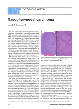 Nasopharyngeal Carcinoma