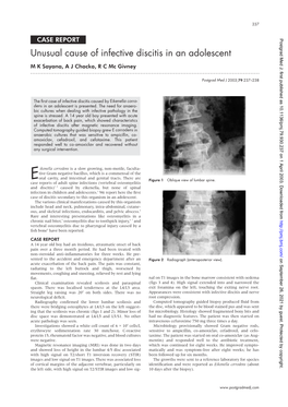 Eikenella Corrodens (About the Left Side, with High Signal on T2/STIR Images and Low Sig- 10 Days After the Biopsy)