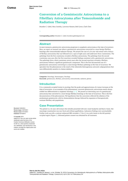 Conversion of a Gemistocytic Astrocytoma to a Fibrillary Astrocytoma After Temozolomide and Radiation Therapy