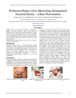 Perforated Peptic Ulcer Mimicking Strangulated Femoral Hernia – a Rare Presentation