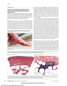 Cutaneous Vasculopathy As an Adverse Effect of the Anti–Vascular