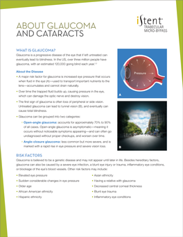 Fact Sheet Glaucoma