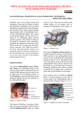 Sialolithiasis: Traditional and Sialendoscopic Techniques