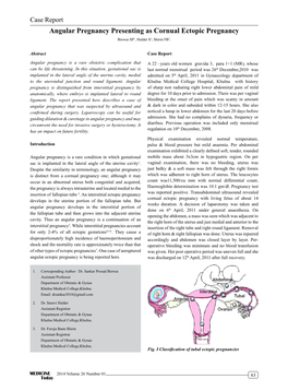 Case Report Angular Pregnancy Presenting As Cornual Ectopic Pregnancy Biswas SP1, Halder S2, Shirin FB3