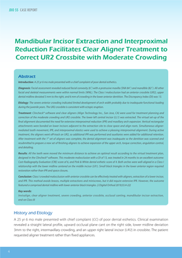 Mandibular Incisor Extraction and Interproximal Reduction Facilitates Clear Aligner Treatment to Correct UR2 Crossbite with Mode