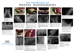 Dental Radiographs