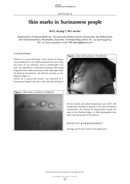 Skin Marks in Surinamese People