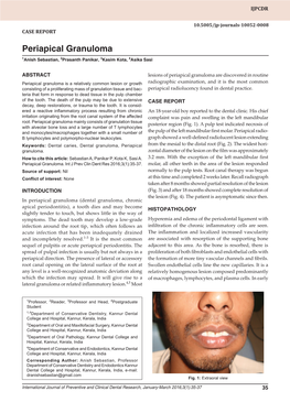 Periapical Granuloma Case Report