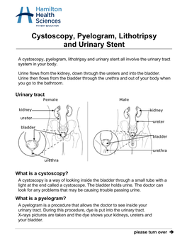 Cystoscopy, Pyelogram, Lithotripsy and Urinary Stent