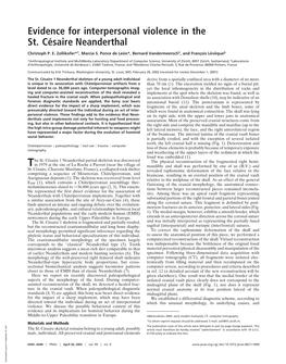 Evidence for Interpersonal Violence in the St. Ce´ Saire Neanderthal