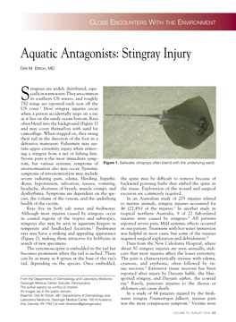 Stingray Injury