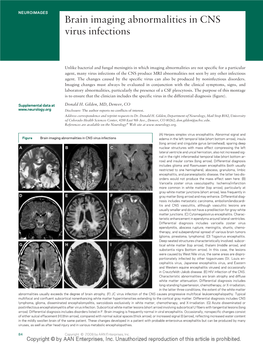 Brain Imaging Abnormalities in CNS Virus Infections