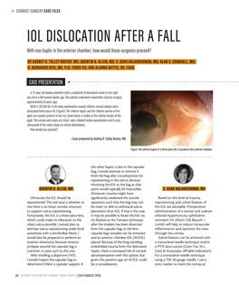 Iol Dislocation After a Fall a After Dislocation Iol Cataract & Refractive Surgery Today Europe