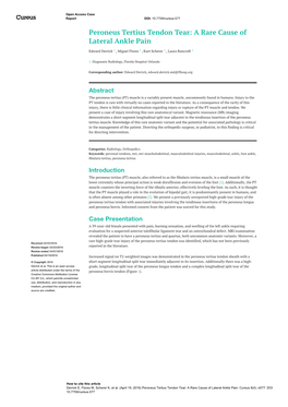 Peroneus Tertius Tendon Tear: a Rare Cause of Lateral Ankle Pain