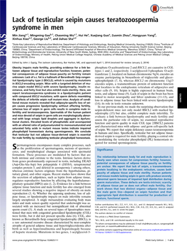 Lack of Testicular Seipin Causes Teratozoospermia Syndrome in Men