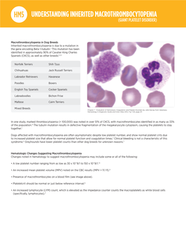 Macrothrombocytosis