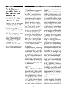 Physical Injury As a Provoking Factor in Three Patients with Scleroderma