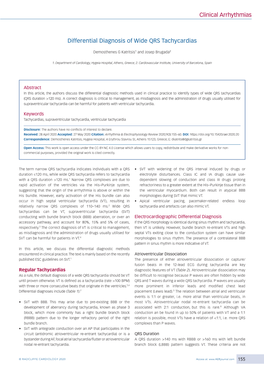 Clinical Arrhythmias Differential Diagnosis of Wide QRS Tachycardias