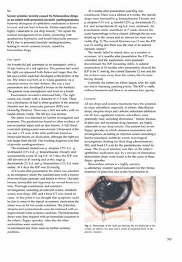 Severe Systemic Toxicity Caused by Brimonidine Drops in an Infant With