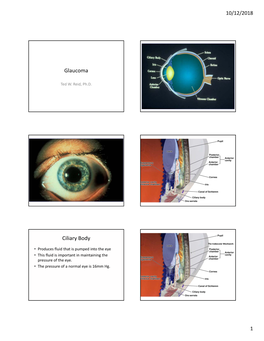 Glaucoma Ciliary Body