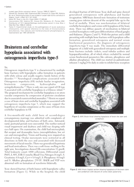 Brainstem and Cerebellar Hypoplasia Associated with Osteogenesis