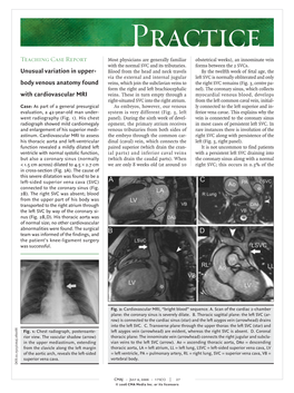 Body Venous Anatomy Found with Cardiovascular MRI