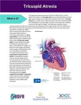 Tricuspid Atresia