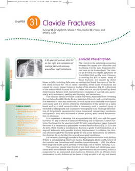 Clavicle Fractures George M
