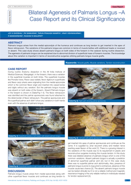 Bilateral Agenesis of Palmaris Longus –A Case Report and Its Clinical Significance Anatomy Section